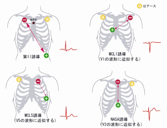 [図]