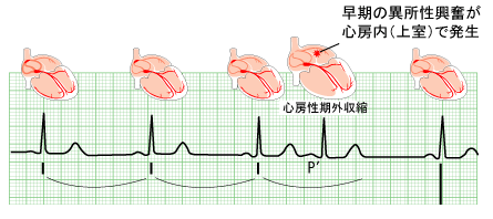 [図]